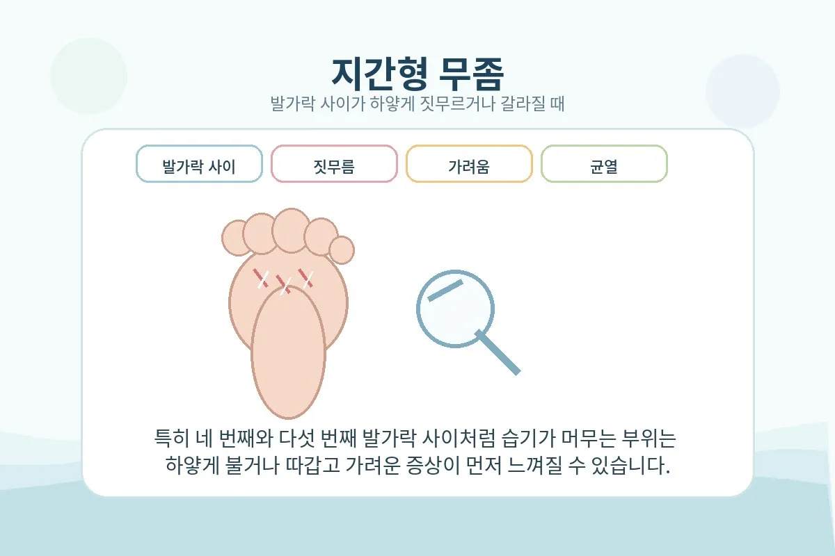 발가락 사이가 하얗게 불고 갈라지는 지간형 예시