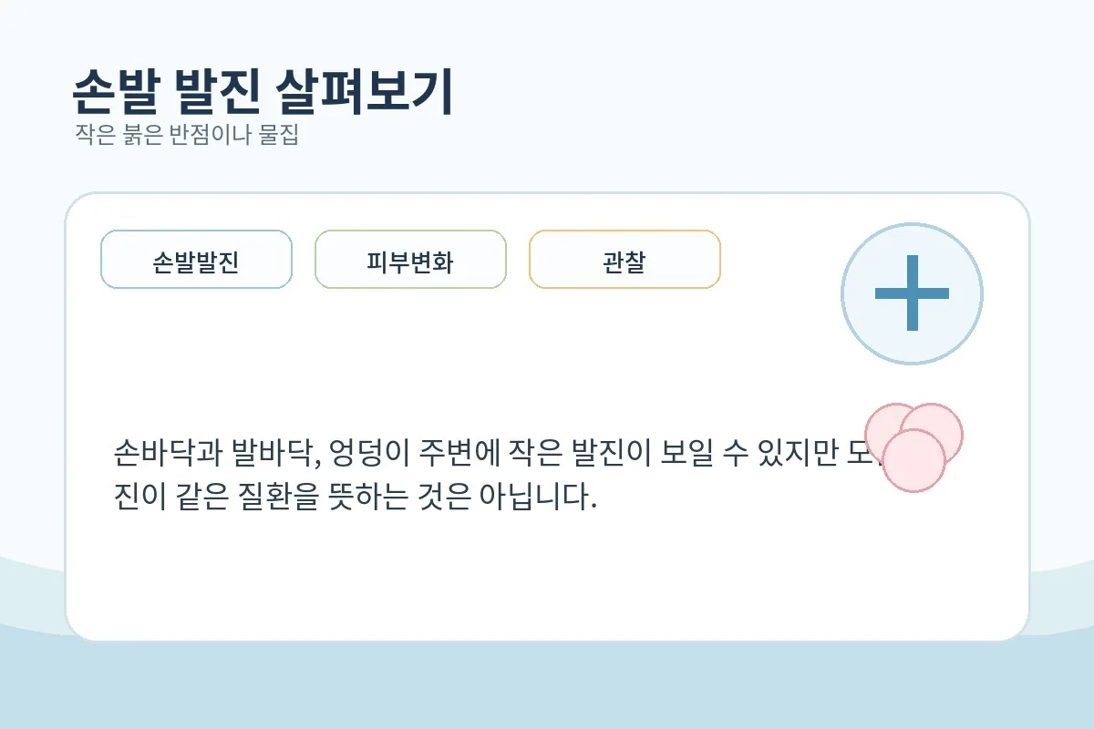손바닥과 발바닥의 작은 발진 위치를 안내형으로 보여주는 의료 정보 일러스트