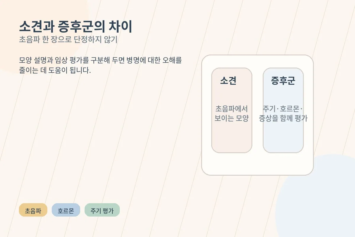 다낭성 난소 모양과 다낭성 난소 증후군의 차이를 비교한 설명 일러스트