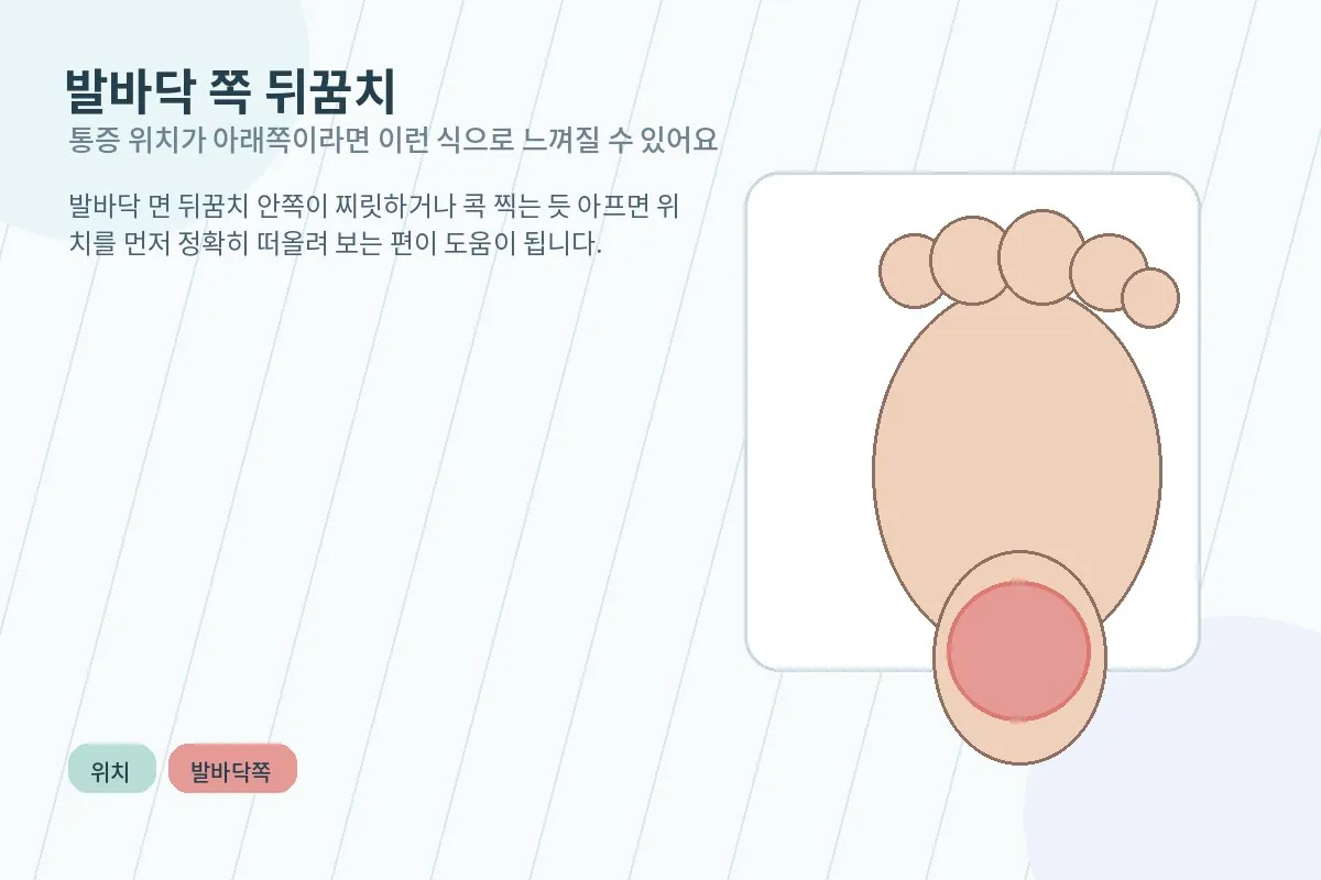 발바닥 쪽 뒤꿈치 통증 위치를 보여주는 안내 그림