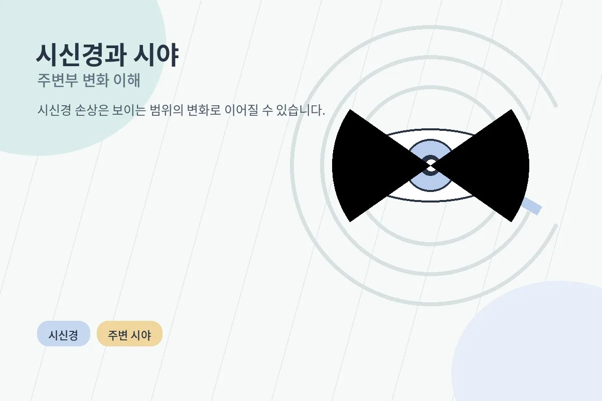 시신경과 시야 변화를 설명하는 눈 그림