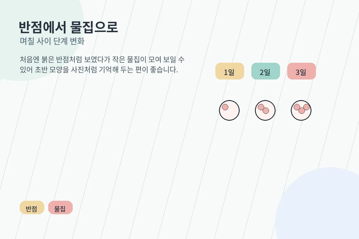 붉은 반점에서 물집으로 이어지는 변화를 설명한 안내 이미지