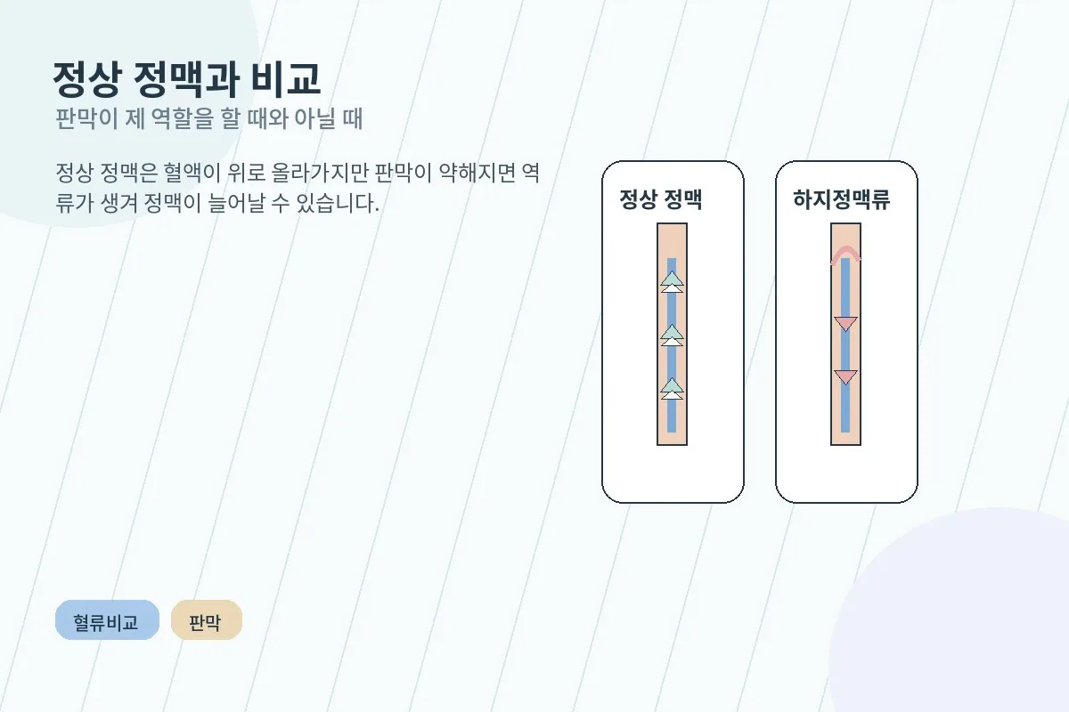 정상 정맥과 하지정맥류에서 혈액 흐름이 어떻게 달라지는지 비교한 일러스트