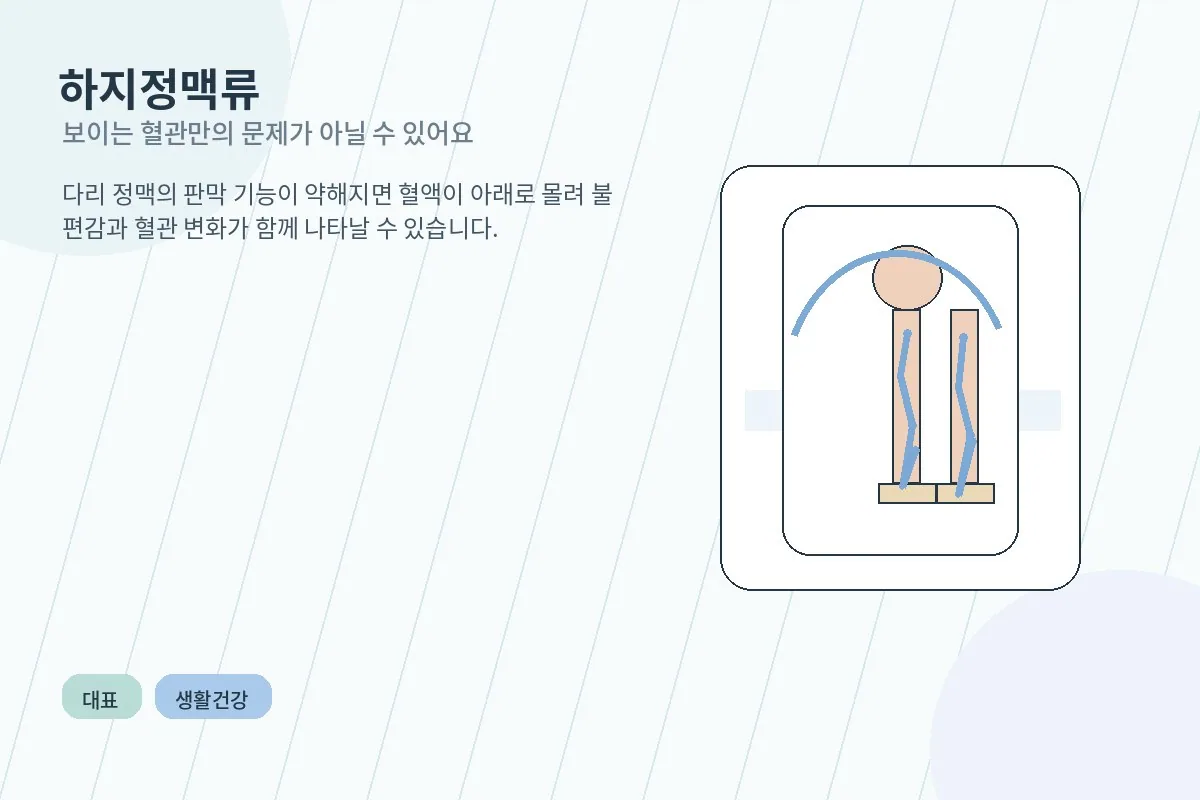 소파에 앉아 다리를 올리고 쉬는 사람의 하체와 은은한 정맥 안내 그래픽