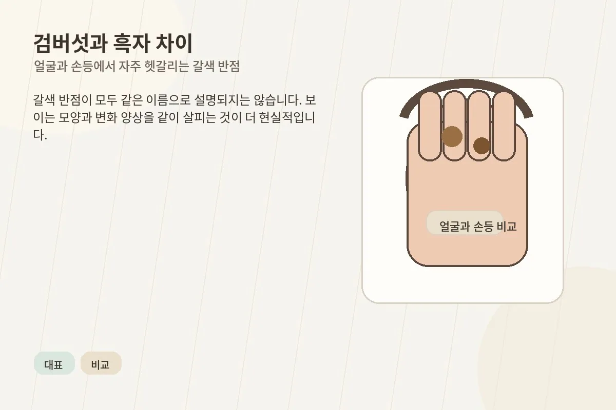 검버섯과 흑자 차이를 얼굴과 손등에서 비교하는 대표 이미지