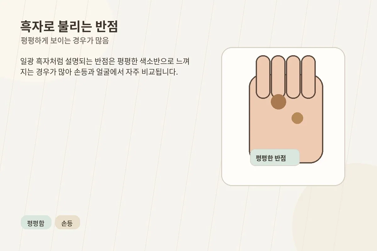 평평한 갈색 반점처럼 보이는 흑자 예시를 설명하는 이미지