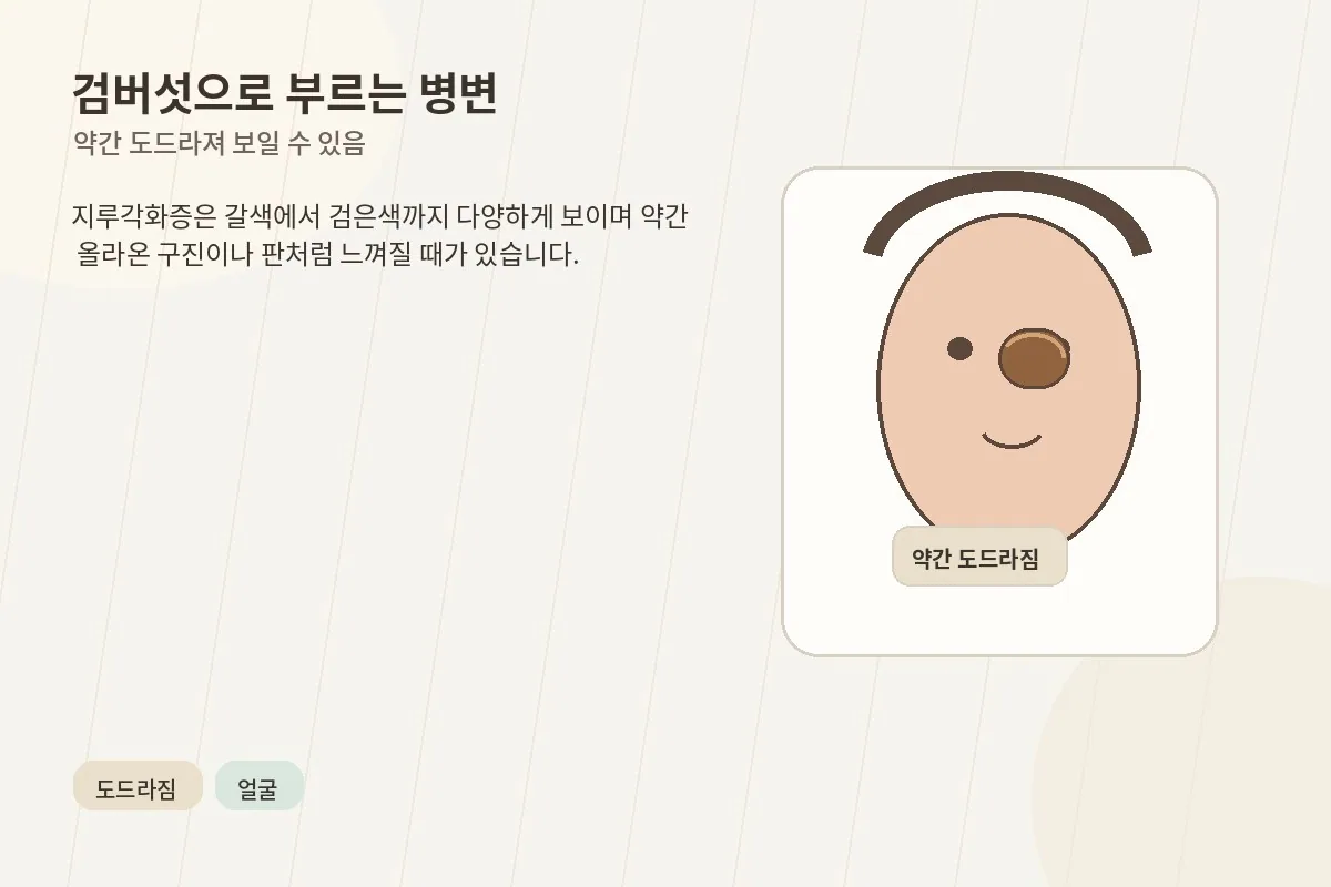 약간 도드라져 보이는 검버섯 모양을 설명하는 이미지