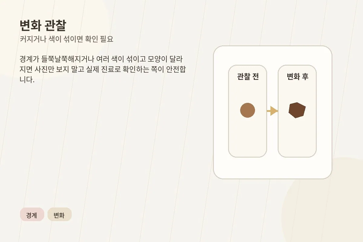 경계와 색 변화가 있는 갈색 반점을 관찰하는 설명 이미지