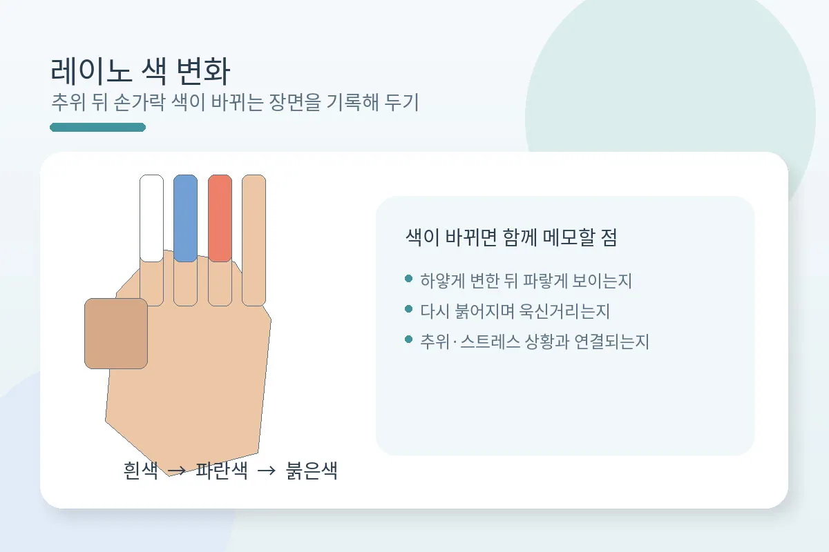 추위에 손가락 색이 하얗거나 파랗게 변하는 레이노현상을 설명하는 이미지