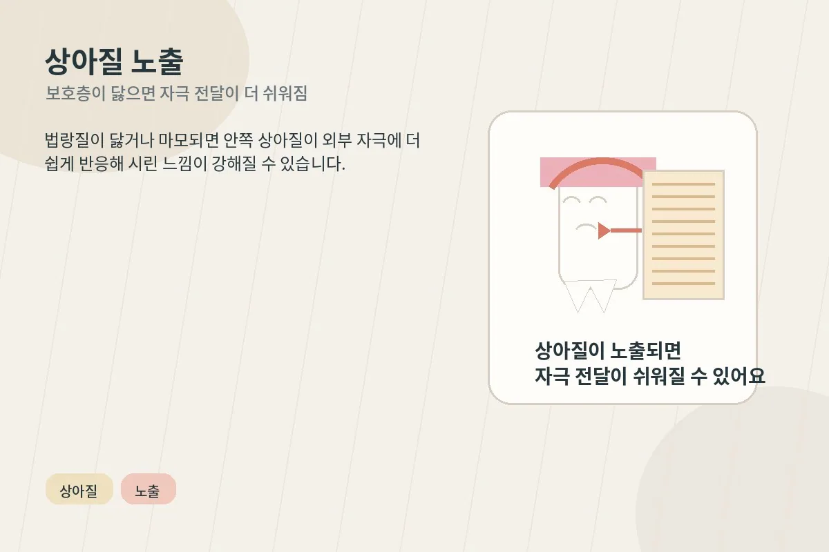 상아질이 노출되면 차갑고 단 자극에 민감해질 수 있음을 설명하는 이미지