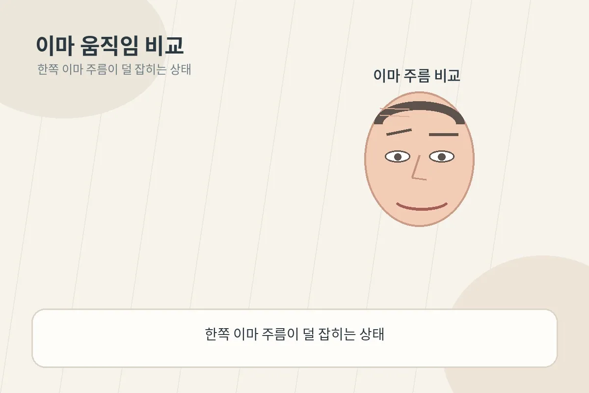 한쪽 이마 주름이 덜 잡히는 차이를 보여주는 비교 이미지