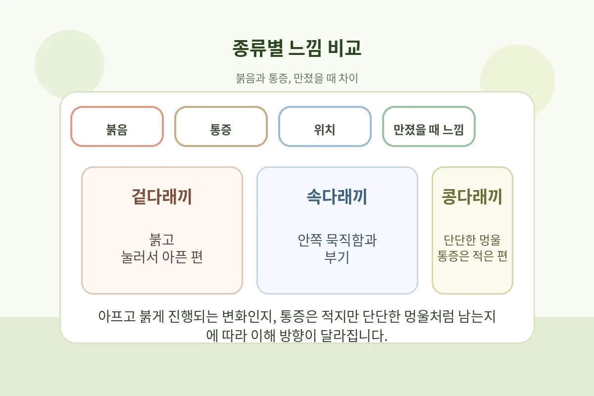 겉다래끼와 속다래끼, 콩다래끼 특징을 비교한 카드형 안내 이미지